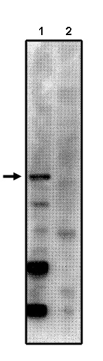 "Western blot analysis
using anti-PP2A/Bγ2
antibody on total rat brain
homogenate with control
peptide (1) and blocking
peptide (2)."